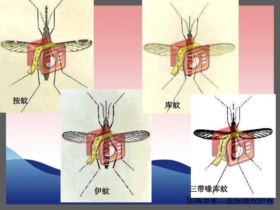 流行性乙型脑炎-运城传染病医院-卫志干.ppt_第5页