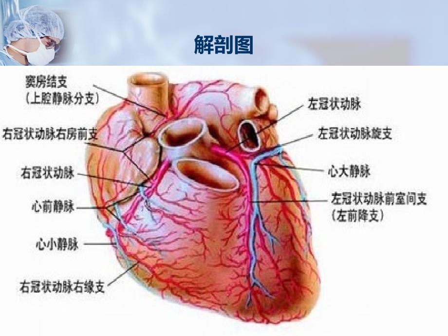 急性心肌梗死的护理查房课件_第2页