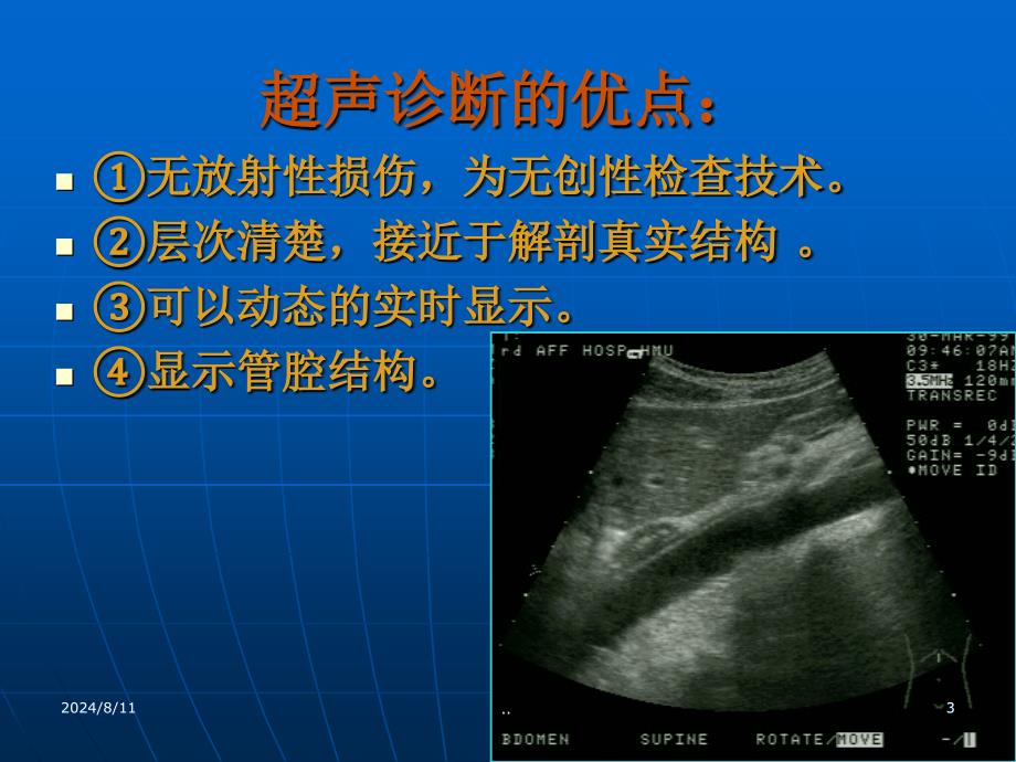 超声诊断学一绪论_第3页