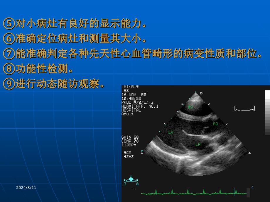 超声诊断学一绪论_第4页