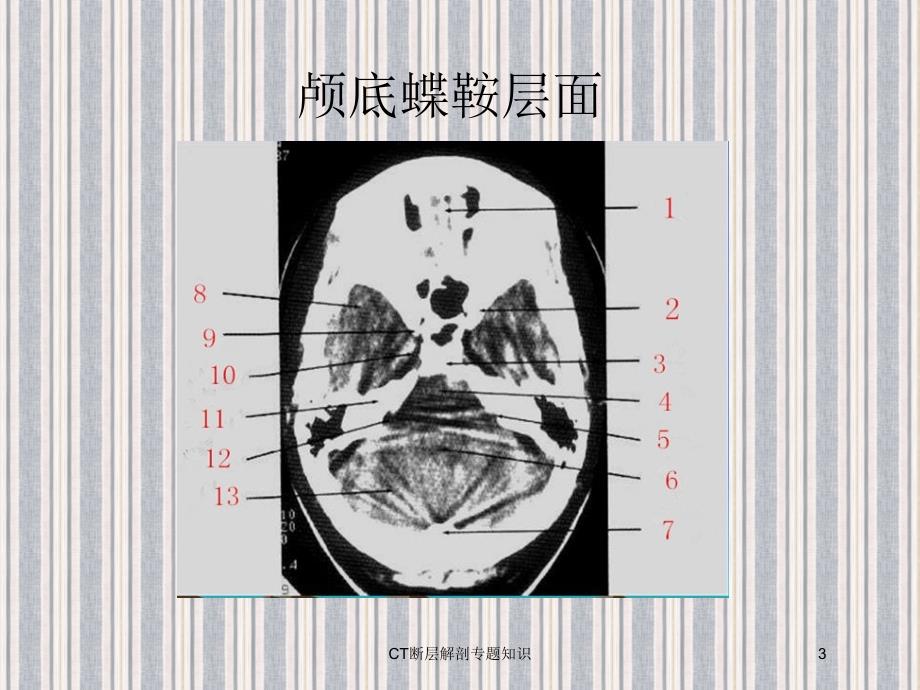 CT断层解剖专题知识培训课件_第3页