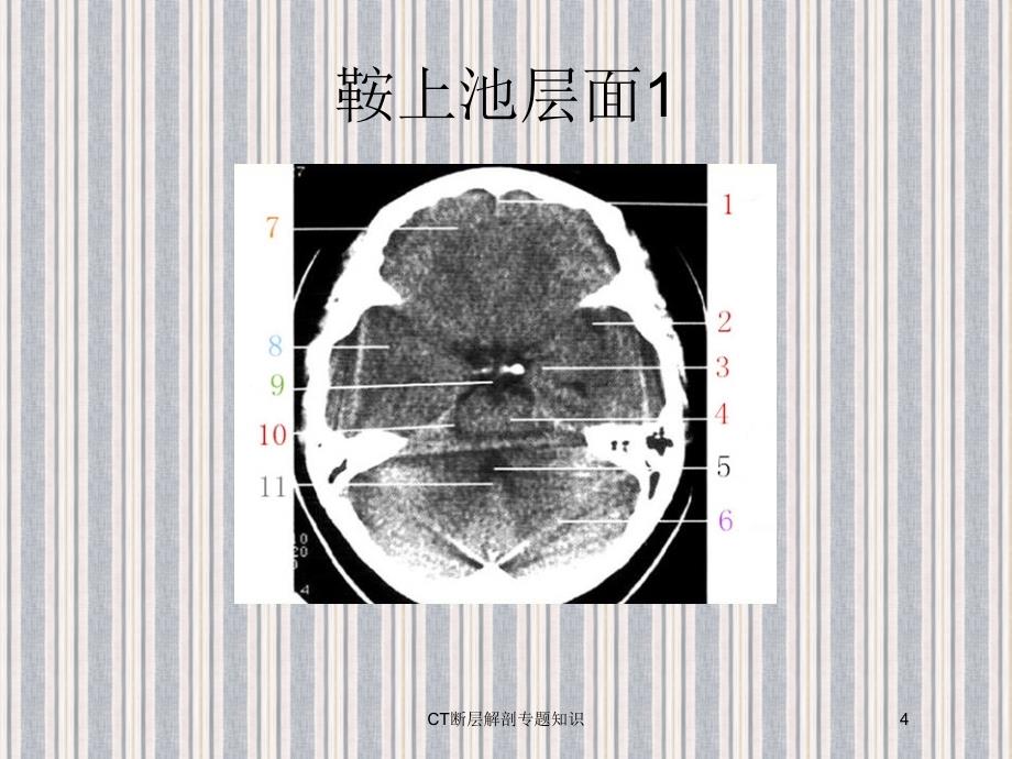 CT断层解剖专题知识培训课件_第4页