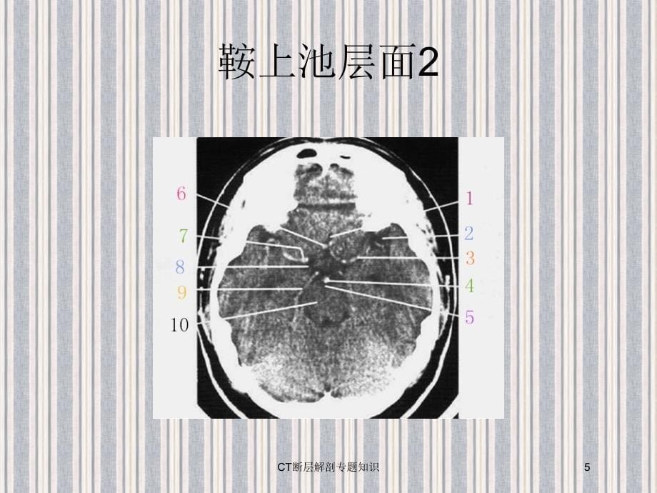 CT断层解剖专题知识培训课件_第5页