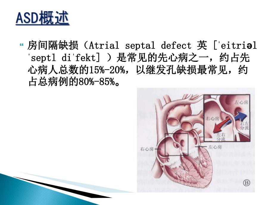 房间隔缺损封堵术的护理_第3页