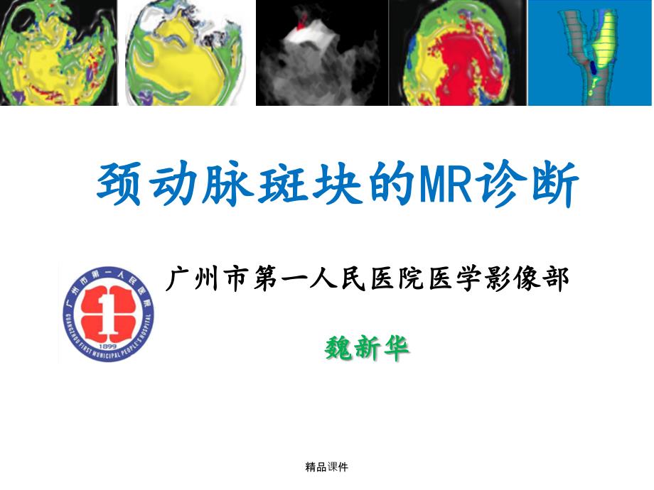 颈动脉斑块的MR诊断课件_第1页