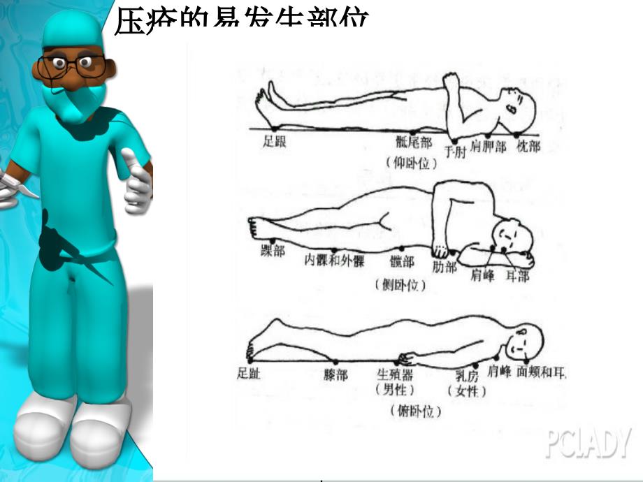 压力性损伤的健康宣教_第3页