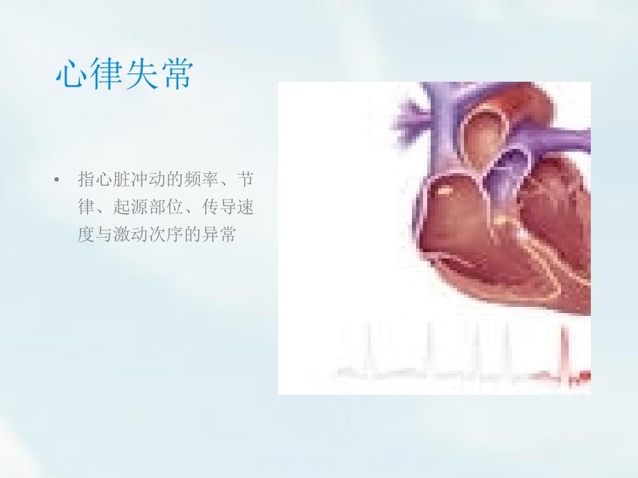 内科护理学循环系统心律失常_第2页