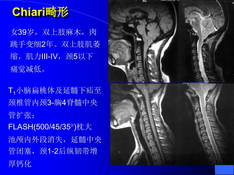 10MRI图像脑1文档资料_第1页