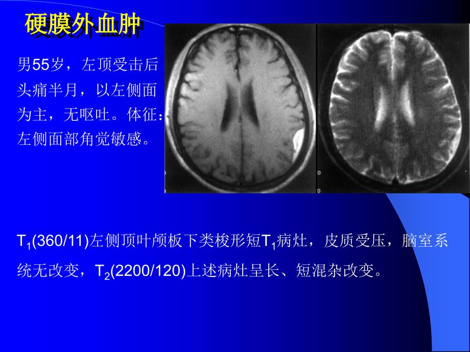 10MRI图像脑1文档资料_第2页