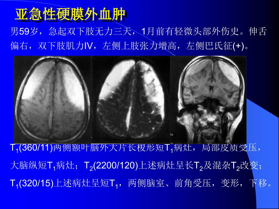 10MRI图像脑1文档资料_第3页