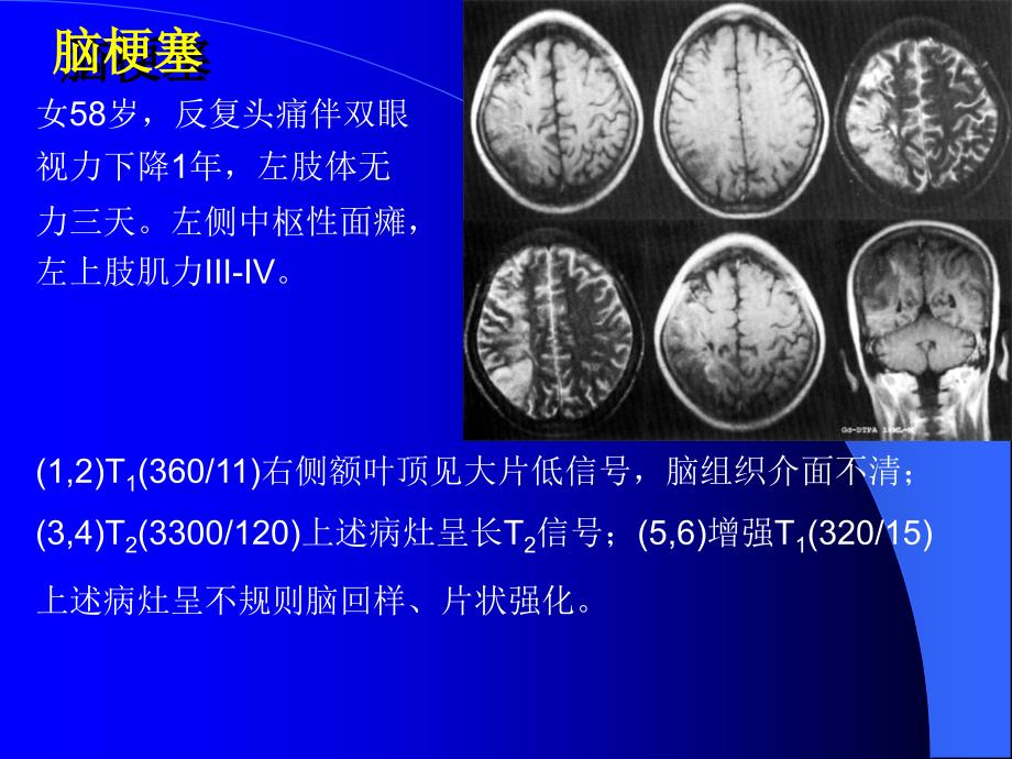 10MRI图像脑1文档资料_第4页