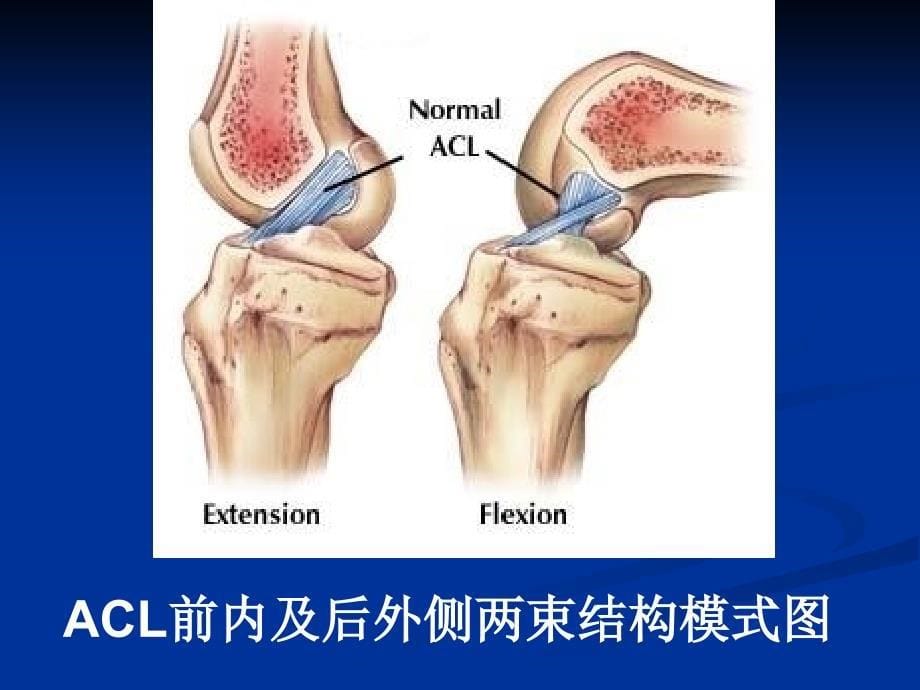 Acl损伤及重建PPT课件_第5页