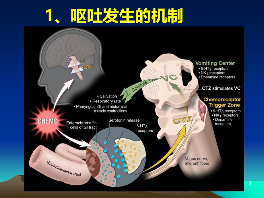 化疗所致的恶心呕吐课件_第3页