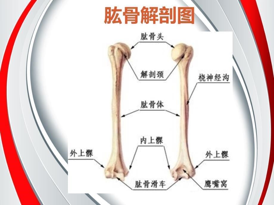 肱骨内固定手术室查房萍萍_第5页