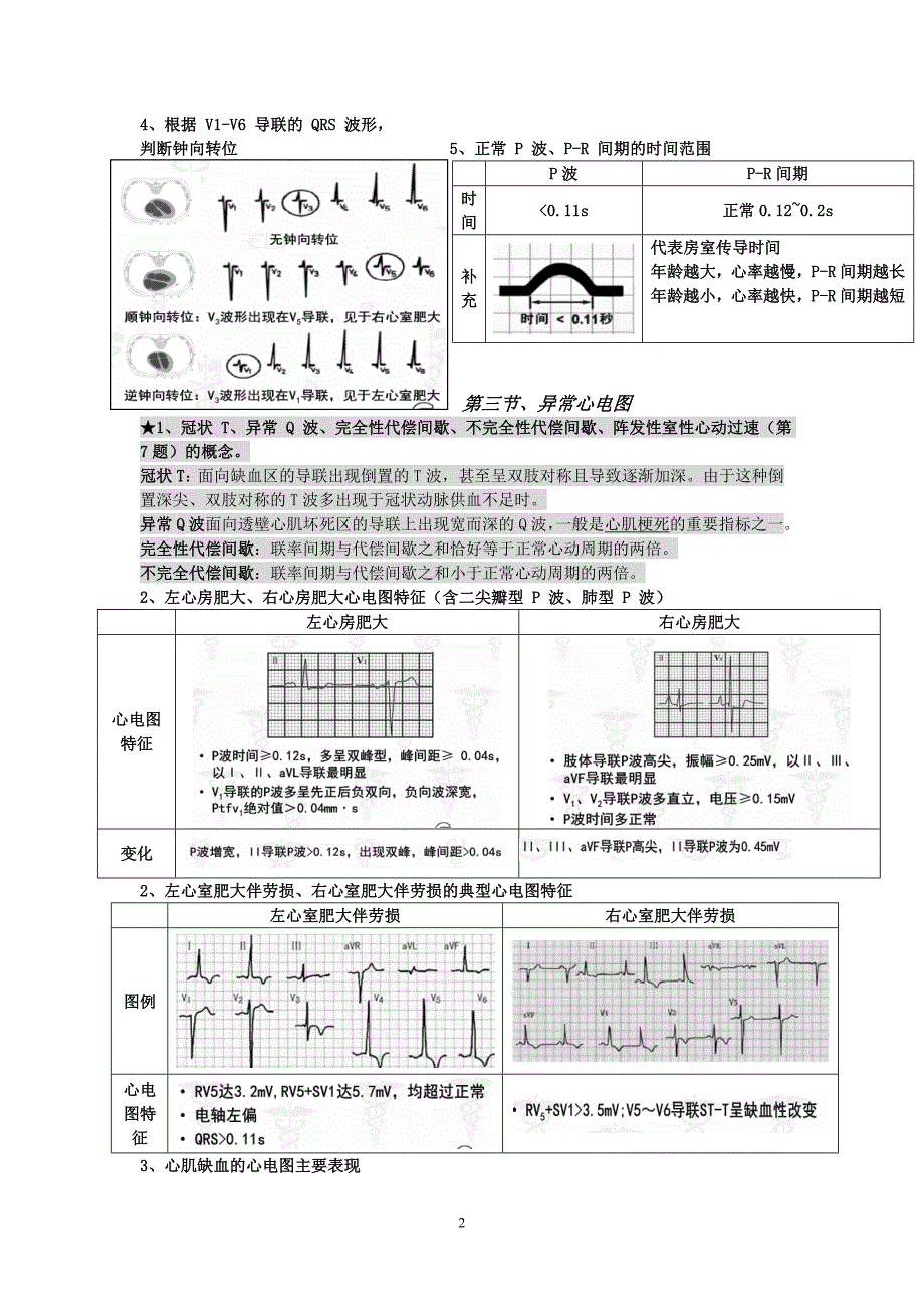 健康评估--心电图重点_第2页