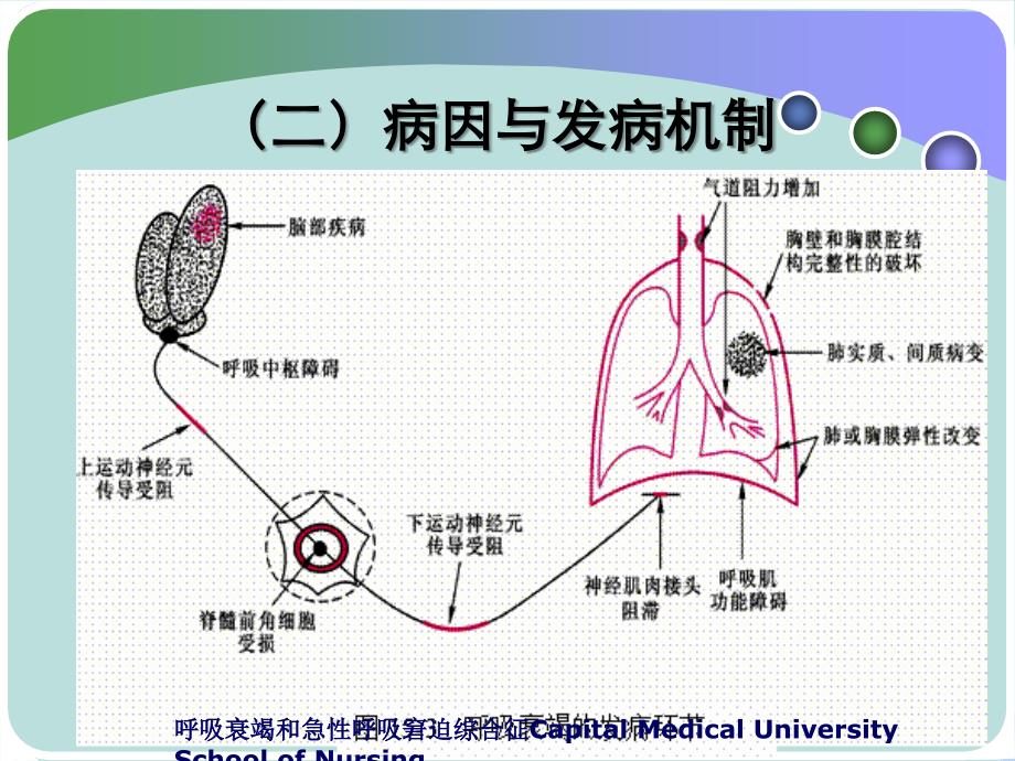 呼吸衰竭和急性呼吸窘迫综合征_第4页