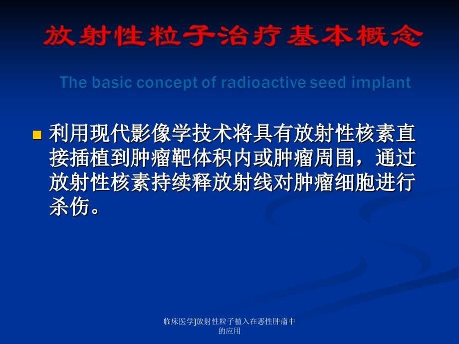 临床医学放射性粒子植入在恶性肿瘤中的应用课件_第5页