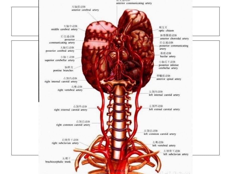 医学专题—椎基底动脉供血不足_第5页