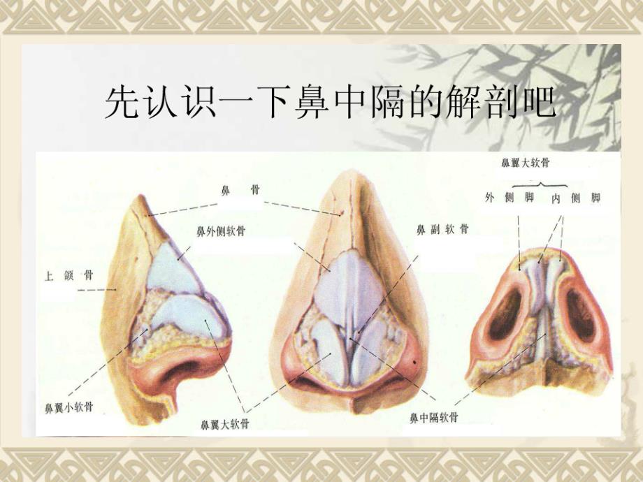 鼻中隔偏曲病人的护理_第3页