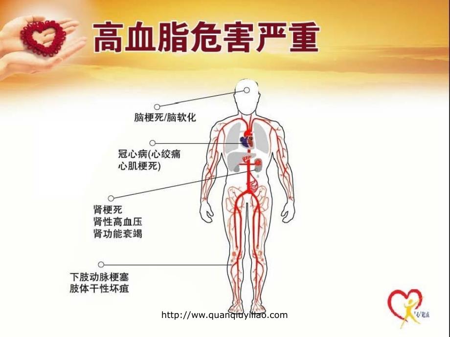 关注高血脂-最精彩的高血脂_第3页