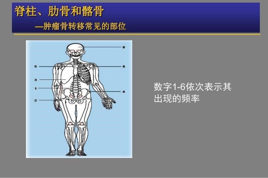 《肿瘤骨转移金尔力》PPT课件_第5页