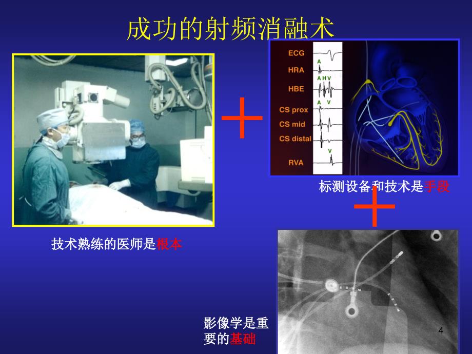 心脏电生理介入治ppt课件_第4页