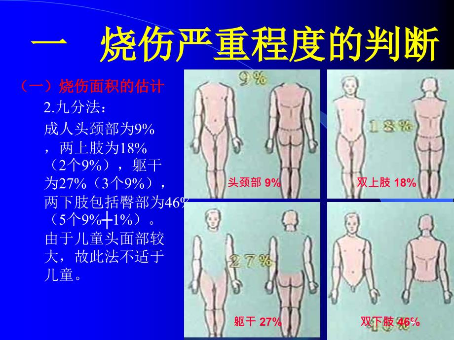 烧伤的现场急救演示PPT_第4页