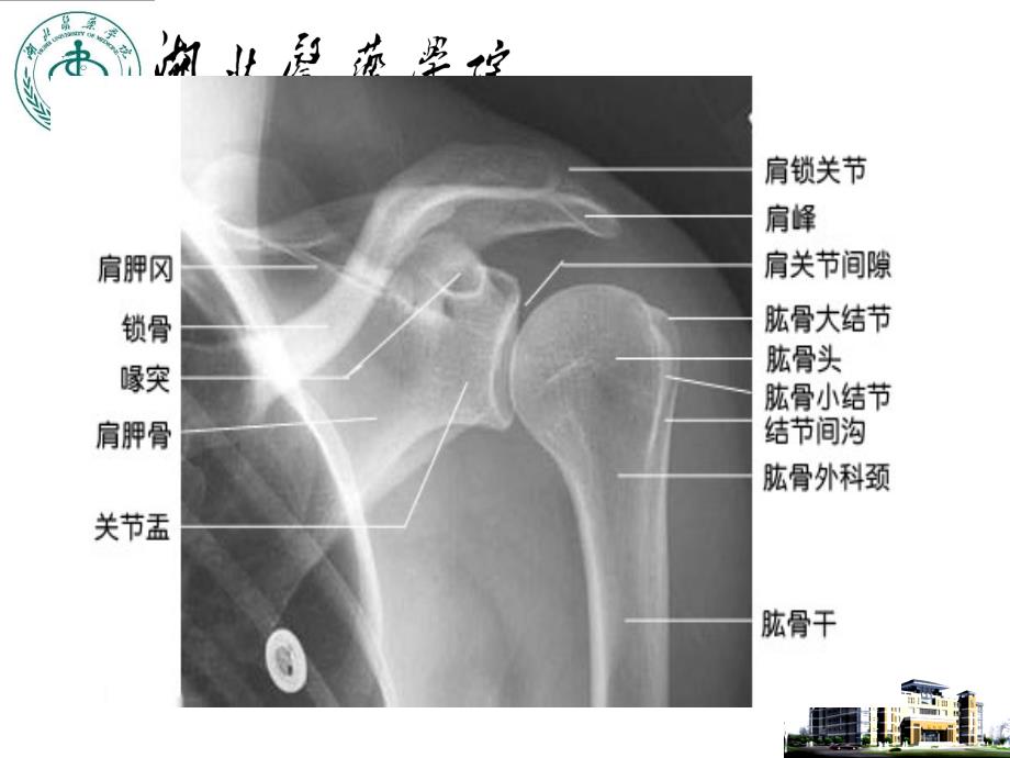 外科学教学课件：上肢骨、关节损伤1_第3页