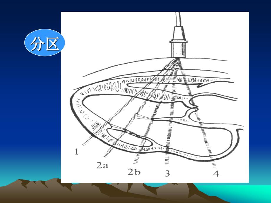 影像诊断学课件：心脏疾病_第3页