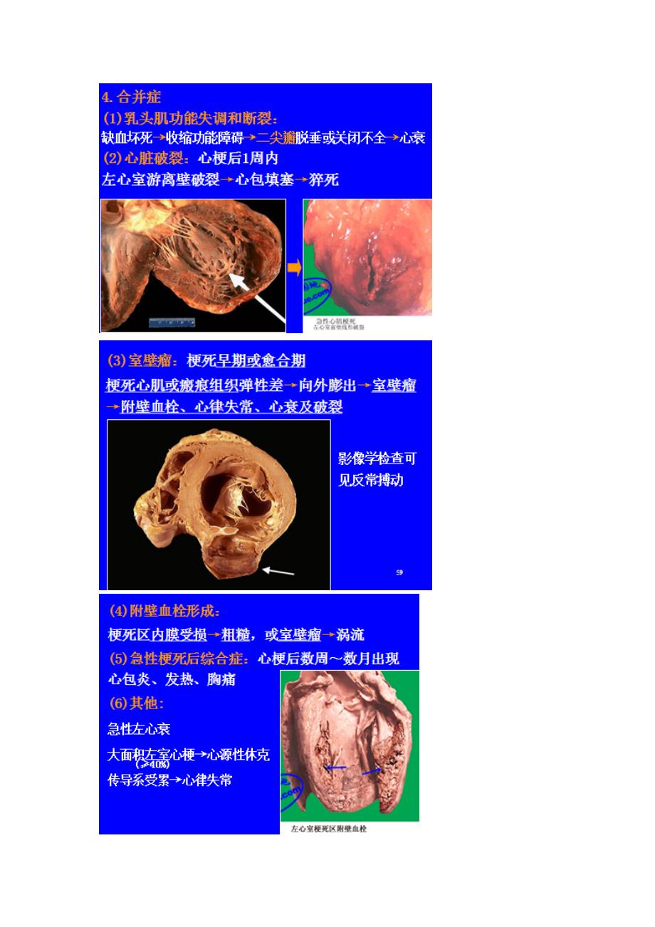 冠状动脉粥样硬化.doc_第3页