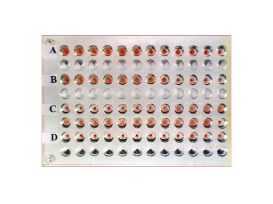 医学专题：试验七-血凝试验1详解_第5页