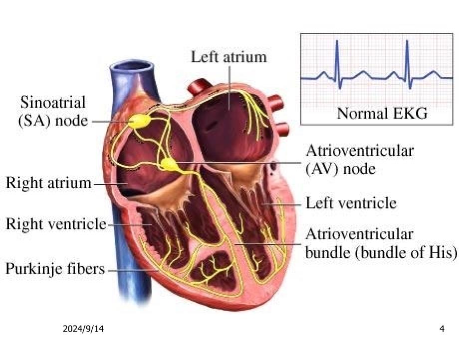 心律失常-1-精选文档课件_第4页