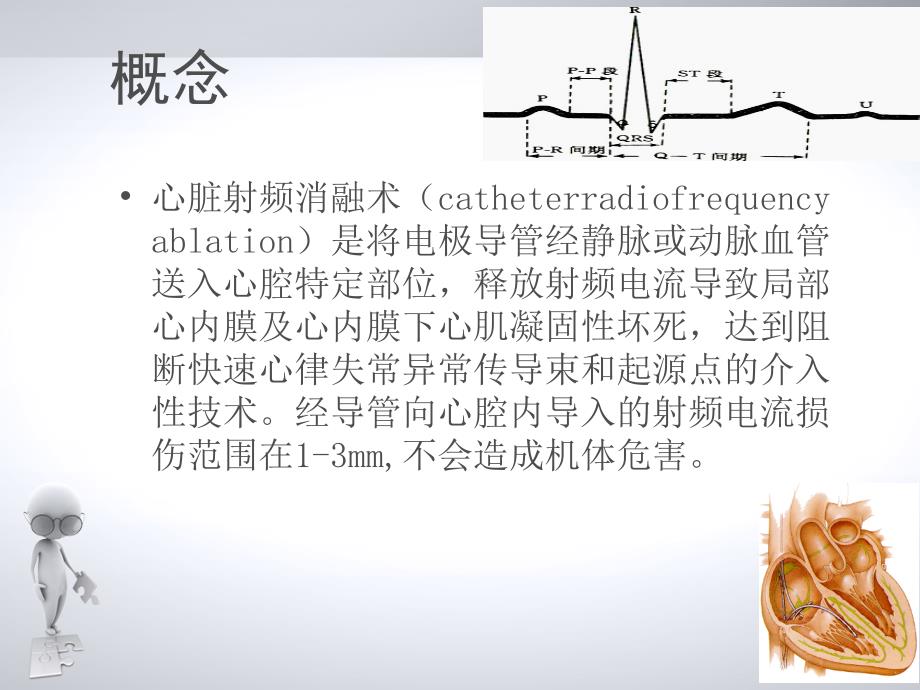 心脏射频消融术_第2页