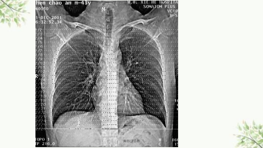 胸部CT诊断课件_第3页