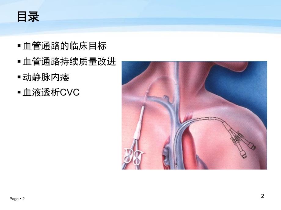 中国血液透析用血管通路专家共识_第2页