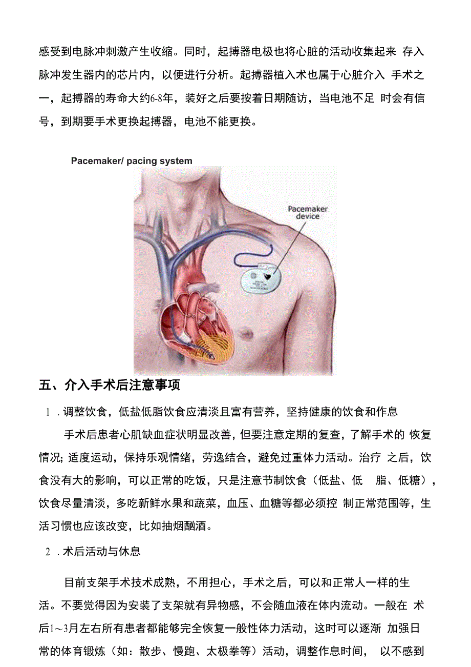 心脏介入简介_第4页