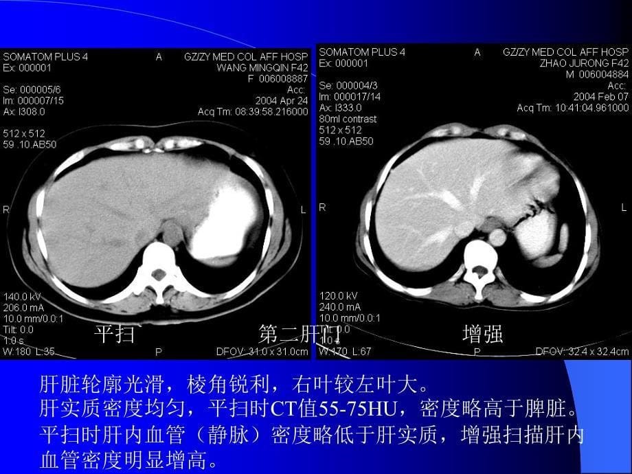 影像学技能培训(CT)_第5页