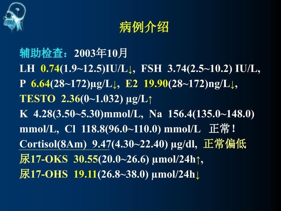 医学交流课件：先天性肾上腺皮质增生症_第5页