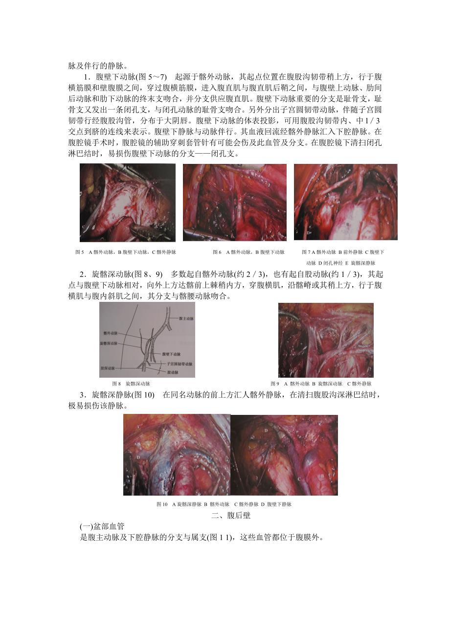 妇科腹腔镜手术相关腹部解剖_第2页