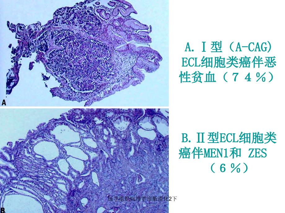 医学组织病理学诊断消化2下课件_第1页