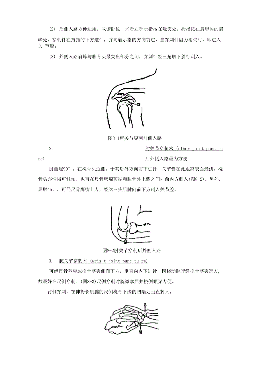 关节腔穿刺术_第3页