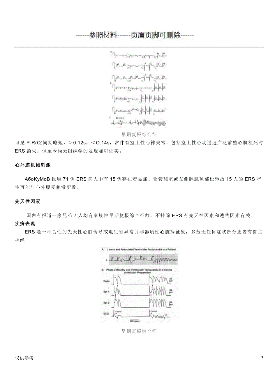 早期复极综合症【医学模板】_第3页