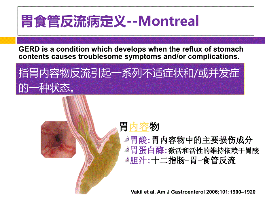 美国GERD指南解读诊断篇张瑞星PPT_第2页