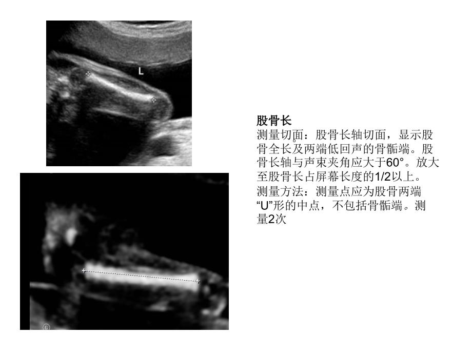 产科超声标准切面25张图_第4页