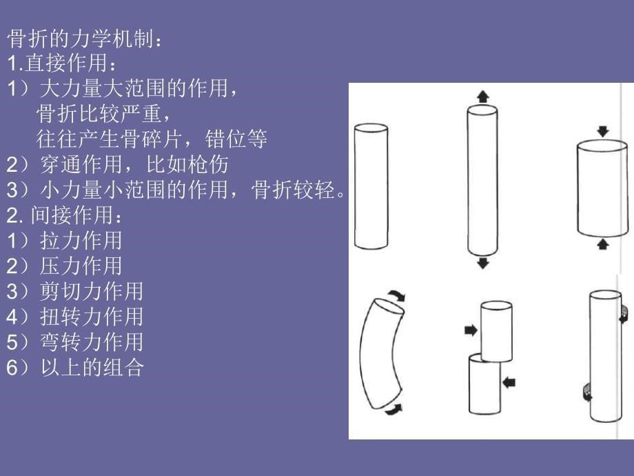 不寻常骨折的影像学分析课件_第5页