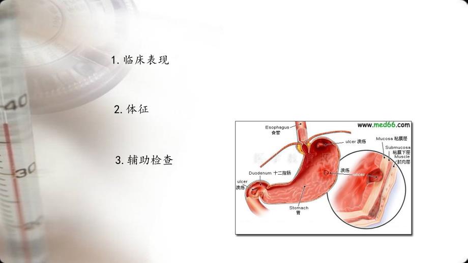 消化性溃疡的诊断与鉴别诊断_第3页