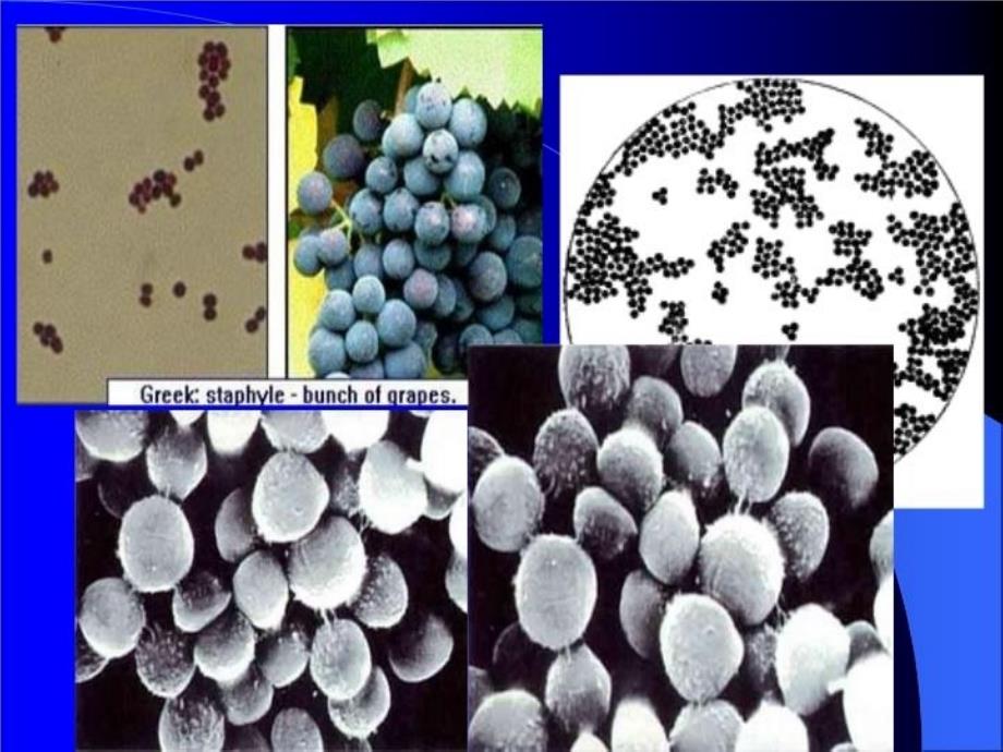 最新医学微生物学七年制大课讲授提纲ppt课件_第4页