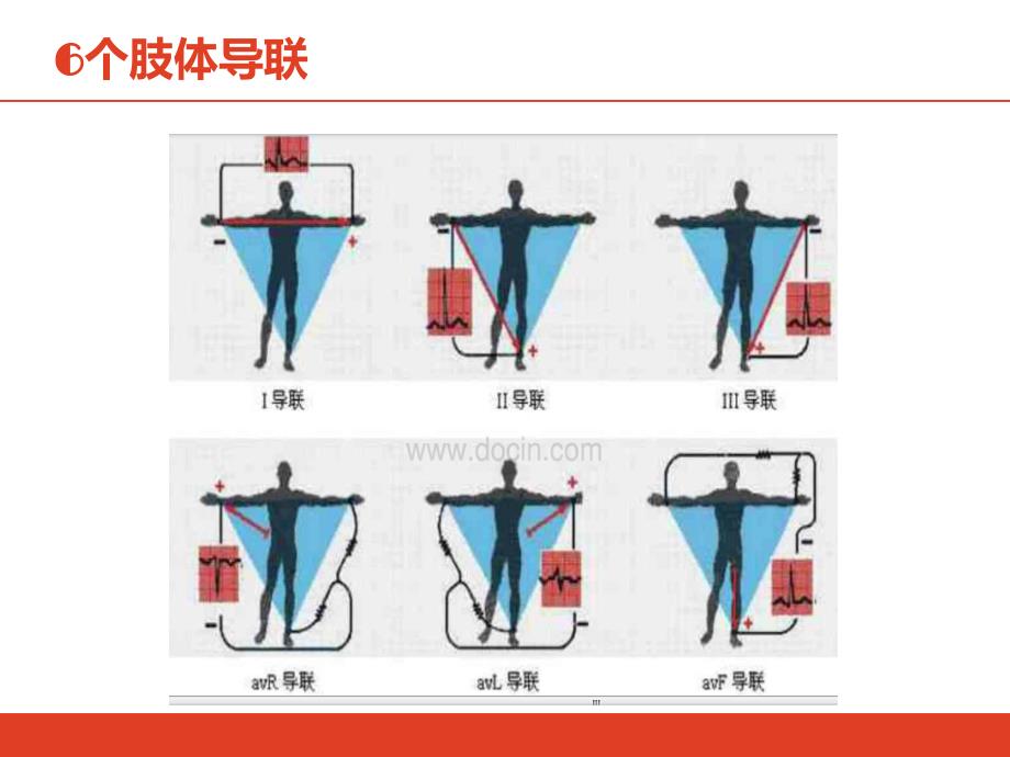 心电图教学课件：ECG的认证_第4页