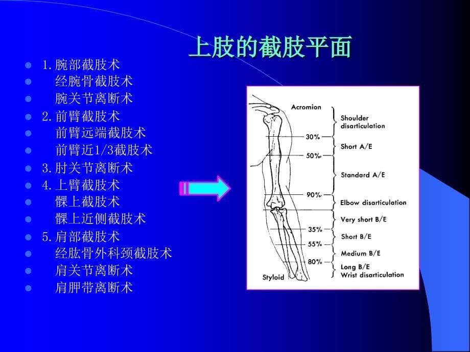 上肢截肢术非常经典_第5页