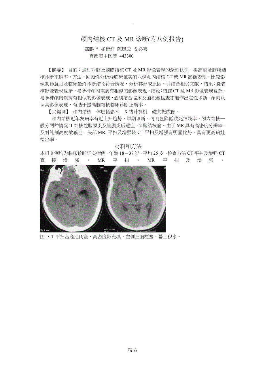 脑结核CT诊断及MRI诊断_第1页